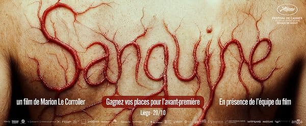 Sanguine